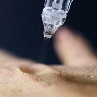 microinfusione Oxi-Jet